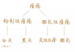 长痘怎么办 调整生活习惯跟痘痘说拜拜