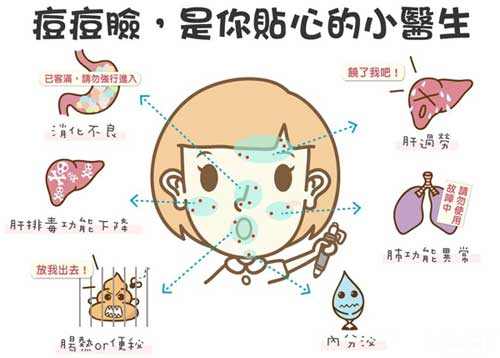 根据脸上长痘位置来治疗痘痘